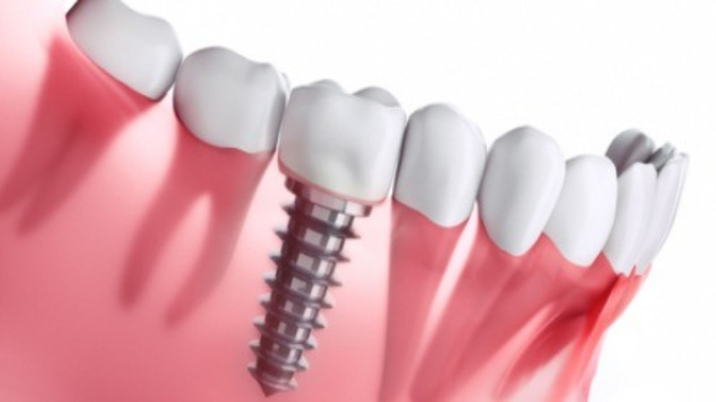 Dentists In West Point, GA Can Deliver Outstanding Oral Care