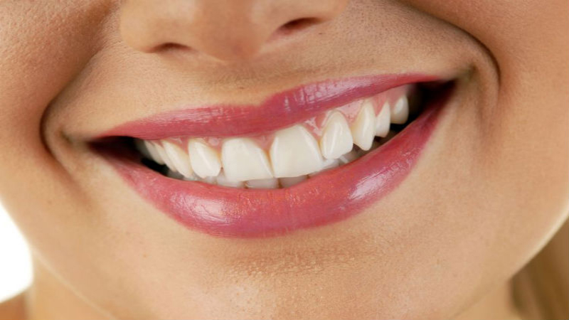 3 Reasons Invisalign In Lakeview May Be The Best Choice