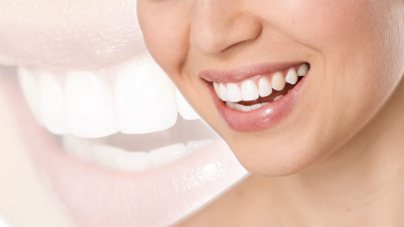 Fast Dental Examination
