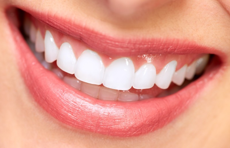 Benefits of Getting a Teeth Whitening Dentist in Houston, Texas